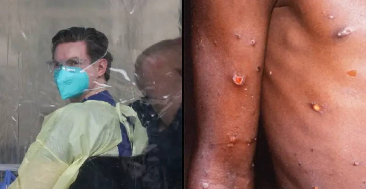 Australia warns after monkeypox detected in US, UK Australia warns after monkeypox detected in US, UK