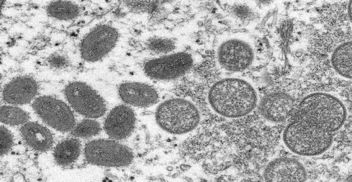 US boosts monkeypox testing, 142 cases confirmed