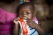 Global hunger crisis pushes one child per minute into severe malnutrition: UNICEF