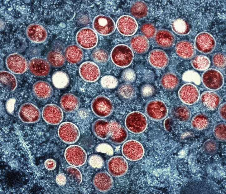 WHO renames monkeypox as mpox, citing racism concerns WHO renames monkeypox as mpox, citing racism concerns